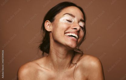 Picture of Skin Conditions