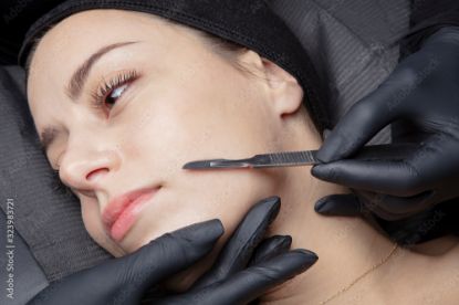 Picture of Dermaplaning 