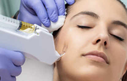 Picture of Mesotherapy